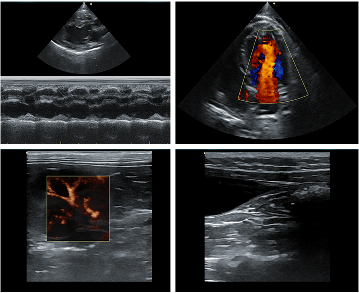 Equipped with an advanced fully digital imaging platform