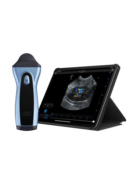 Wireless Handheld Ultrasound Device VPIU1D Wireless Handheld Ultrasound Device VPIU1D