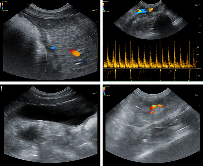 Clear Ultrasound Imaging