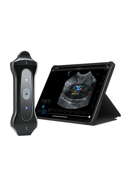 Wireless Handheld Ultrasound Device PAU2B Wireless Handheld Ultrasound Device PAU2B