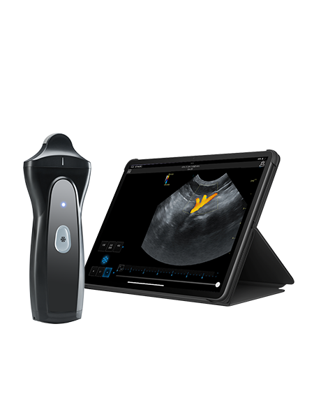 Wireless Handheld Ultrasound Device VPAU1D 