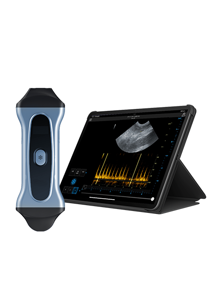 Wireless Handheld Ultrasound Device PIU2B Wireless Handheld Ultrasound Device PIU2B