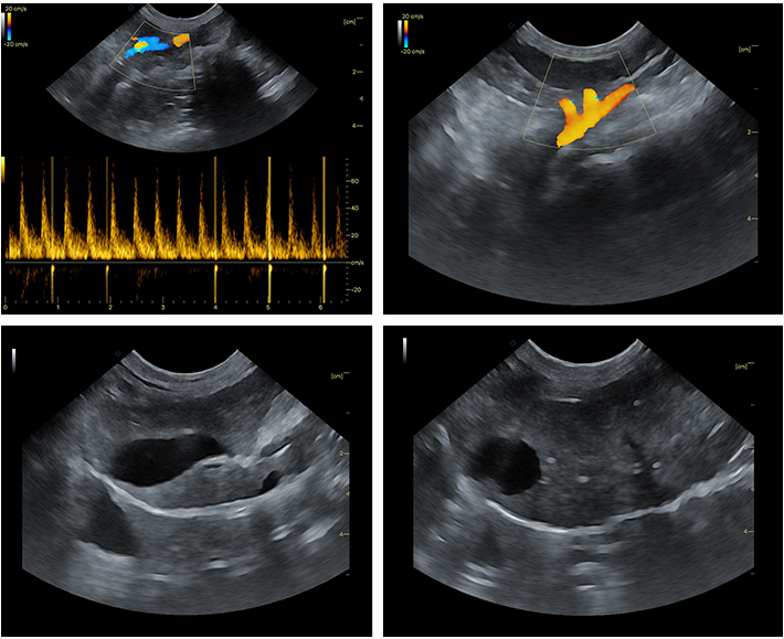 Clear Ultrasound Imaging