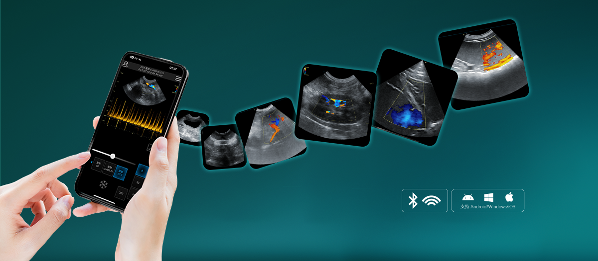 AI-Powered Auxiliary Diagnosis
