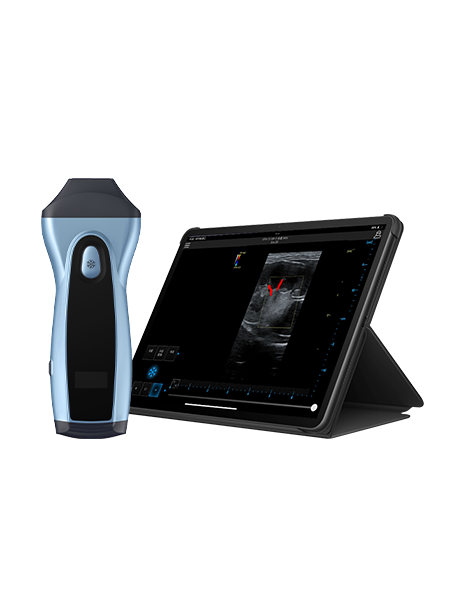 Wireless Handheld Ultrasound Device VPIU1C Wireless Handheld Ultrasound Device VPIU1C