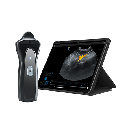 Wireless Handheld Ultrasound Device VPAU1D