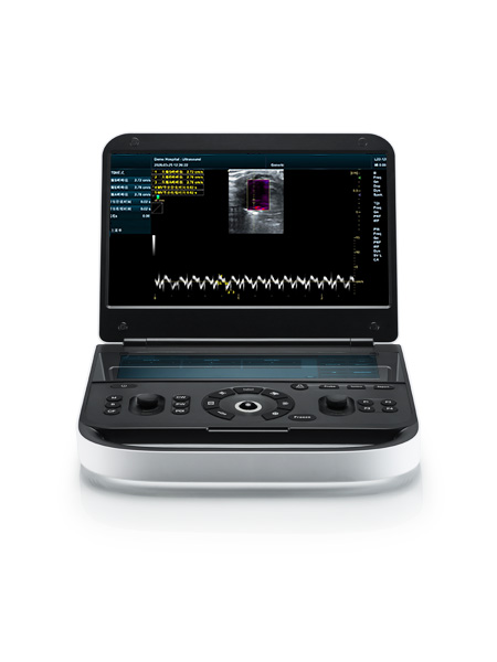 Revo 9 Vet Ultrasound Machine for Small Animals 